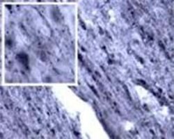 RALA Polyclonal Antibody, Invitrogen 100 &mu;L | Buy Online | Invitrogen | Fisher Scientific