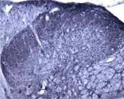 RALA Polyclonal Antibody, Invitrogen 100 &mu;L | Buy Online | Invitrogen | Fisher Scientific