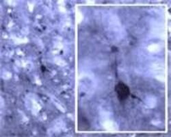 RALA Polyclonal Antibody, Invitrogen 100 &mu;L | Buy Online | Invitrogen | Fisher Scientific