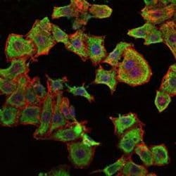 Invitrogen RBP4 Monoclonal Antibody (4C2) 100 &mu;L; Unconjugated:Antibodies,
