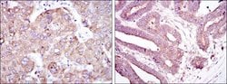 Invitrogen RBP4 Monoclonal Antibody (4C2) 100 &mu;L; Unconjugated:Antibodies,