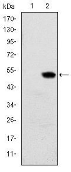 Invitrogen RBP4 Monoclonal Antibody (4C2) 100 &mu;L; Unconjugated:Antibodies,