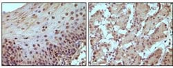Invitrogen Rb Monoclonal Antibody (7E4B8) 100 &mu;L; Unconjugated:Antibodies,