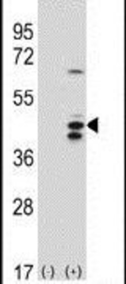 RCL1 Rabbit anti-Human, Polyclonal, Invitrogen 400 &mu;L; Unconjugated:Antibodies,