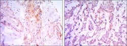 Invitrogen RICTOR Monoclonal Antibody (7B3) 100 &mu;L; Unconjugated:Antibodies,