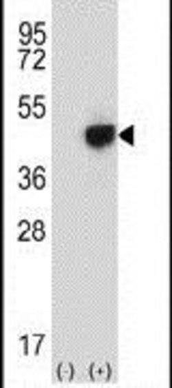 RMND5B Rabbit anti-Human, Polyclonal, Invitrogen 400 &mu;L; Unconjugated:Antibodies,