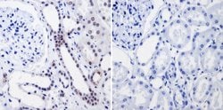 Invitrogen RPA2 Monoclonal Antibody (MA34) 100 &mu;L; Unconjugated:Antibodies,