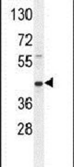 RPH3AL Rabbit anti-Human, Polyclonal, Invitrogen 400 &mu;L; Unconjugated:Antibodies,