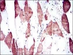 Invitrogen p70 S6 Kinase Monoclonal Antibody (5G9) 100 &mu;g; Unconjugated:Antibodies,