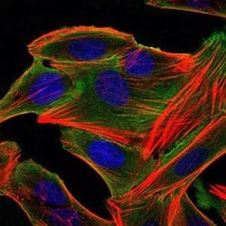 Invitrogen RSK2 Monoclonal Antibody (4E10) 100 &mu;L; Unconjugated:Antibodies,