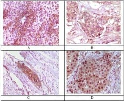 Invitrogen RAB25 Monoclonal Antibody (3F12F3) 100 &mu;g; Unconjugated:Antibodies,