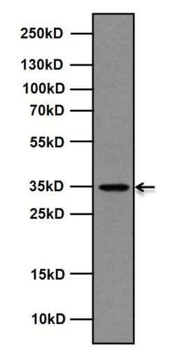 Invitrogen Rex1 Recombinant Rabbit Monoclonal Antibody (14H16L9) 100 &mu;g;