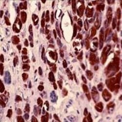 S100A4 Rabbit anti-Human, Polyclonal, Invitrogen 100&mu;L; Unconjugated:Anticuerpos