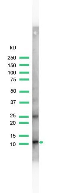 S100A4 Rabbit anti-Human, Polyclonal, Invitrogen 100&mu;L; Unconjugated:Anticuerpos