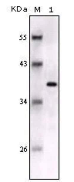 Invitrogen S100B Monoclonal Antibody (9A11B9) 100 &mu;L; Unconjugated:Antibodies,