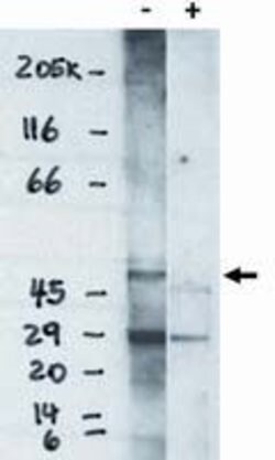 Invitrogen EDG6 Polyclonal Antibody 100 &mu;g; Unconjugated:Antibodies,