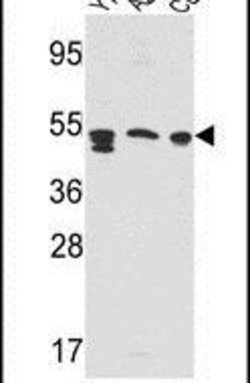 PSAP Rabbit anti-Human, Polyclonal, Invitrogen 400 &mu;L; Unconjugated:Antibodies,