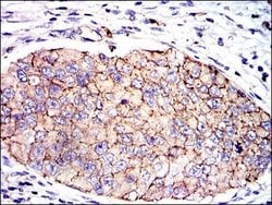 Invitrogen PAI1 Monoclonal Antibody (1D5) 100 &mu;g; Unconjugated:Antibodies,