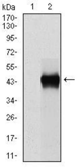 Invitrogen PAI1 Monoclonal Antibody (1D5) 100 &mu;g; Unconjugated:Antibodies,