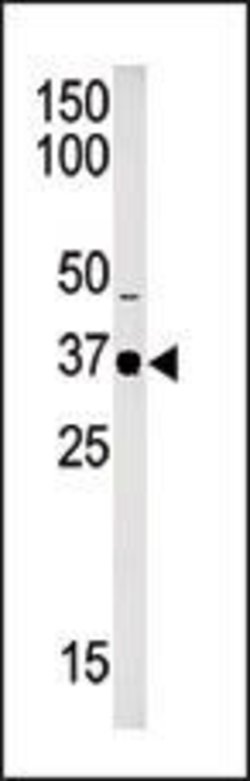 SETD7 Rabbit anti-Human, Mouse, Polyclonal, Invitrogen 400 &mu;L; Unconjugated:Antibodies,