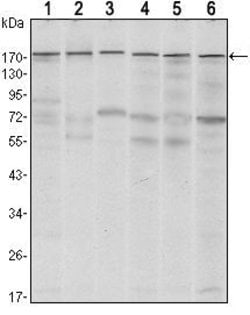 Invitrogen SETDB1 Monoclonal Antibody (5H6D4) 100 &mu;L; Unconjugated:Antikroppar