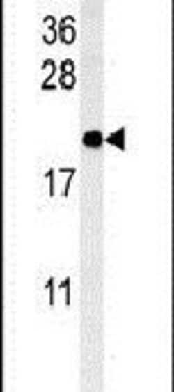 SFT2D3 Rabbit anti-Human, Polyclonal, Invitrogen 400 &mu;L; Unconjugated:Antibodies,
