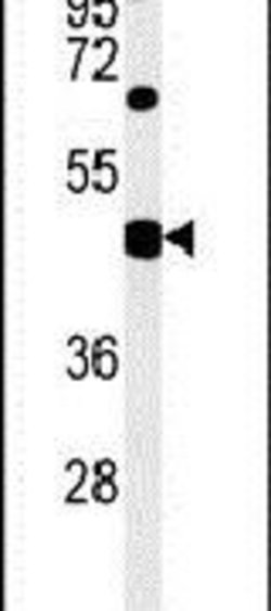 SH2D2A Rabbit anti-Human, Polyclonal, Invitrogen 400 &mu;L; Unconjugated:Antibodies,