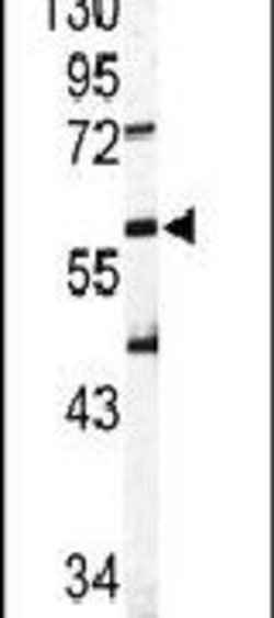 SIGLEC6 Rabbit anti-Human, Polyclonal, Invitrogen 400 &mu;L; Unconjugated:Antibodies,