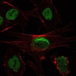 Invitrogen SIRT1 Monoclonal Antibody (1F3) 100 &mu;L; Unconjugated:Antibodies,