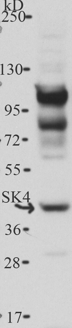 Invitrogen KCNN4 Polyclonal Antibody 50 &mu;g; Unconjugated:Antibodies,