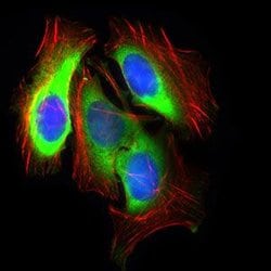 Invitrogen GLUT4 Monoclonal Antibody (3G10A3) 100 &mu;g; Unconjugated:Antibodies,