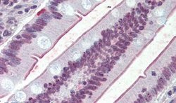 SGLT1 Polyclonal Antibody, Invitrogen 50 &mu;g; Unconjugated:Antibodies,