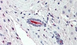 SGLT1 Polyclonal Antibody, Invitrogen 50 &mu;g; Unconjugated:Antibodies,