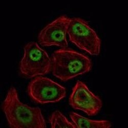 Invitrogen SMC1 Monoclonal Antibody (5B6) 100 &mu;L; Unconjugated:Antibodies,