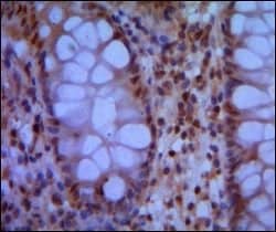 Invitrogen SMC1 Monoclonal Antibody (5B6) 100 &mu;L; Unconjugated:Antibodies,