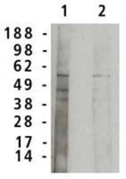Invitrogen ASM Polyclonal Antibody 100 &mu;g; Unconjugated:Antibodies,