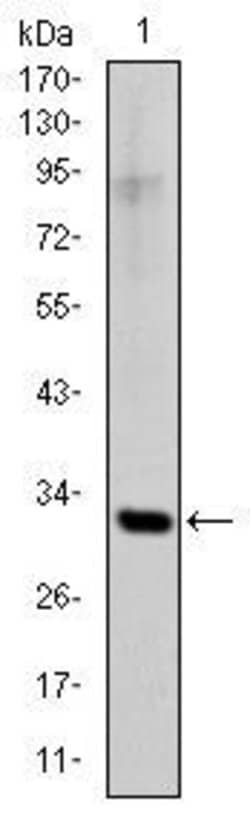 Invitrogen SNAIL Monoclonal Antibody (6D2) 100 &mu;L | Buy Online | Invitrogen&trade; | Fisher Scientific