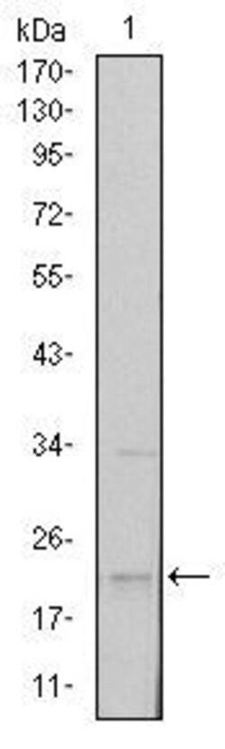 Invitrogen SNAIL Monoclonal Antibody (6D2) 100 &mu;L | Buy Online | Invitrogen&trade; | Fisher Scientific