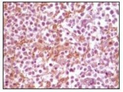 Invitrogen alpha Synuclein Monoclonal Antibody (2B2D1, 2B2A11) 100 &mu;L;