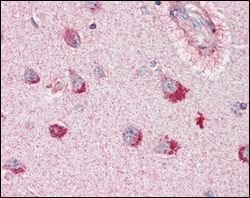 Invitrogen SORL1 Monoclonal Antibody (3B6B11) 100 &mu;L; Unconjugated:Antibodies,