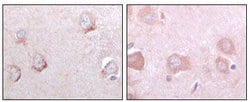 Invitrogen SORL1 Monoclonal Antibody (3B6B11) 100 &mu;L; Unconjugated:Antibodies,