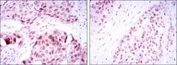 SOX2 Monoclonal Antibody (10F10):Antibodies, Monoclonal