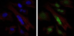 Invitrogen SOX9 Monoclonal Antibody (1B11) 100 &mu;g; Unconjugated:Antibodies,