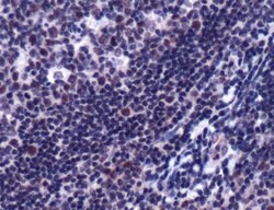 SP1 Rabbit anti-Human, Polyclonal, Invitrogen 500 &mu;L; Unconjugated:Antibodies,