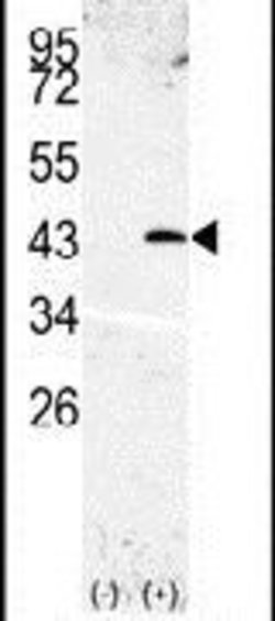 SPPL3 Rabbit anti-Human, Polyclonal, Invitrogen 400 &mu;L; Unconjugated:Antibodies,