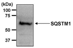 Invitrogen SQSTM1 Polyclonal Antibody 100 μg; Unconjugated:Antibodies,