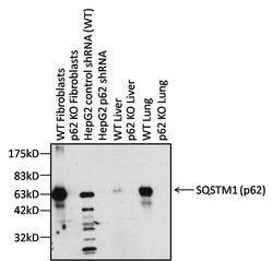 Invitrogen SQSTM1 Polyclonal Antibody 100 μg; Unconjugated:Antibodies,