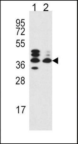 SRD5A3 Rabbit anti-Human, Polyclonal, Invitrogen 400 &mu;L; Unconjugated:Antibodies,