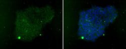 Invitrogen SSEA3 Monoclonal Antibody (MC-631) 100 &mu;g; Unconjugated:Antibodies,