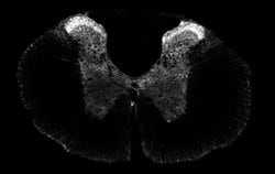 SSTR1 Polyclonal Antibody:Antibodies, Polyclonal